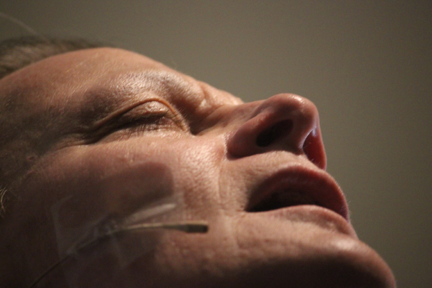 Nahaufnahme eines Frauengesichts während einer Behandlung mit Nadeln in der Nase, Augen geschlossen, vor einer Wand.